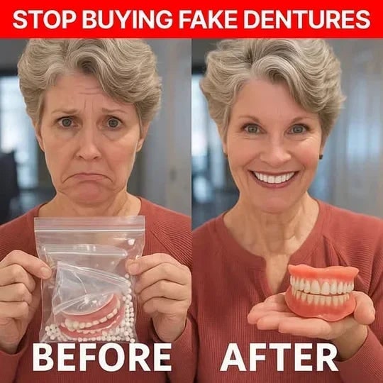 Affordable Removable Dentures with Flexible Cushion Grip Full Arch Set Cleaning - Image 4