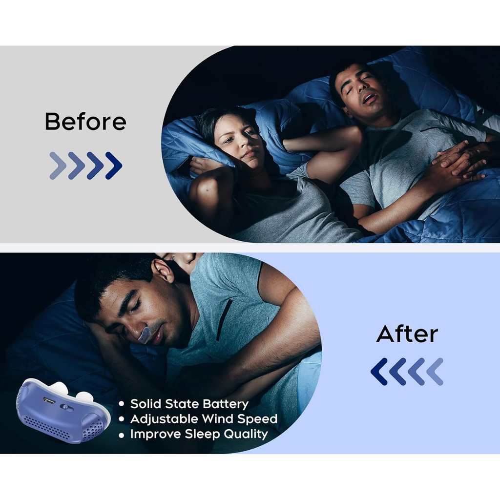 Anti Snoring Device Sleep Apnea Silicone Rechargeable Portable Travel Electric - Image 8