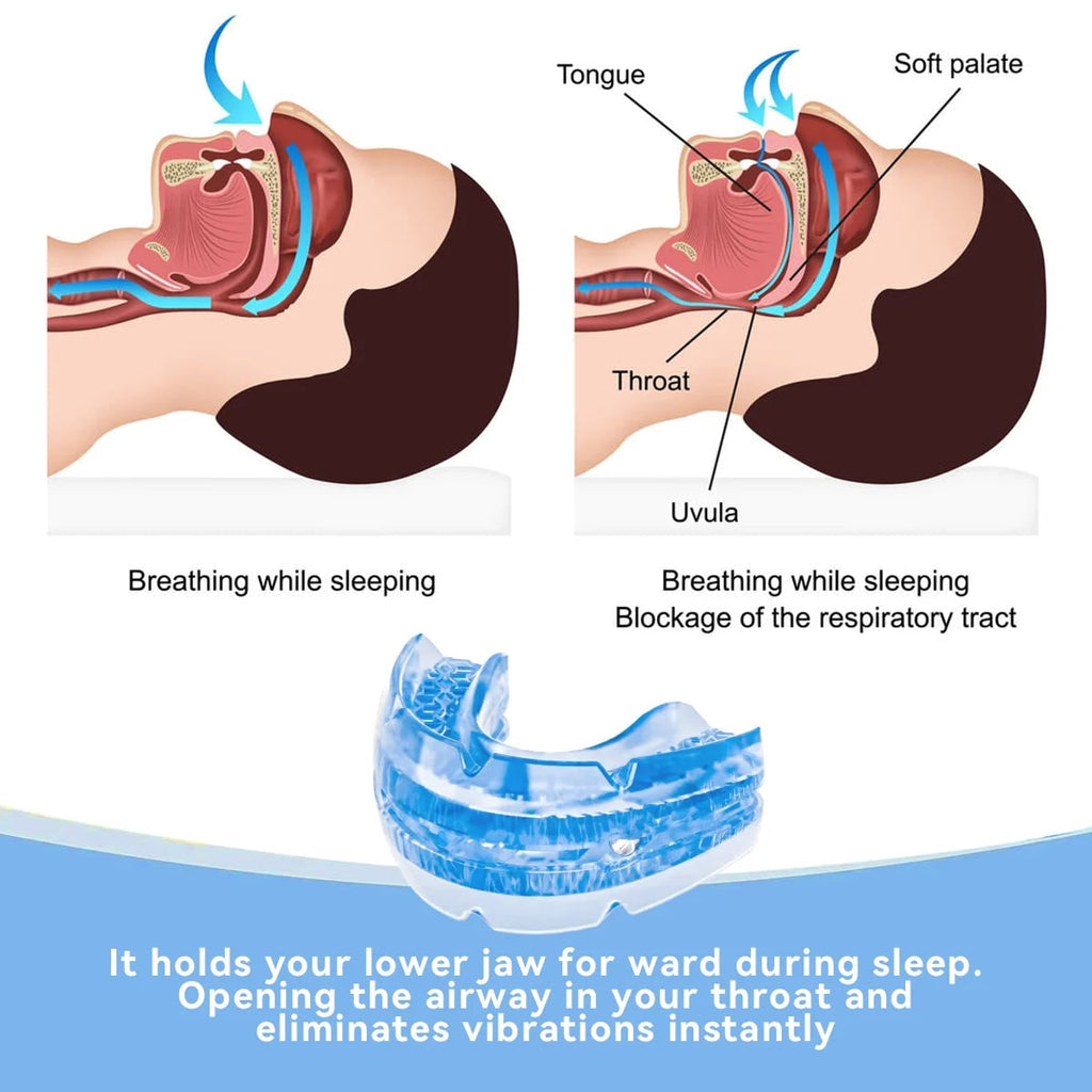 Anti Snoring Mouthpiece Mouth Guard Adjustable Portable Storage Case Screwdriver Aid - Image 3
