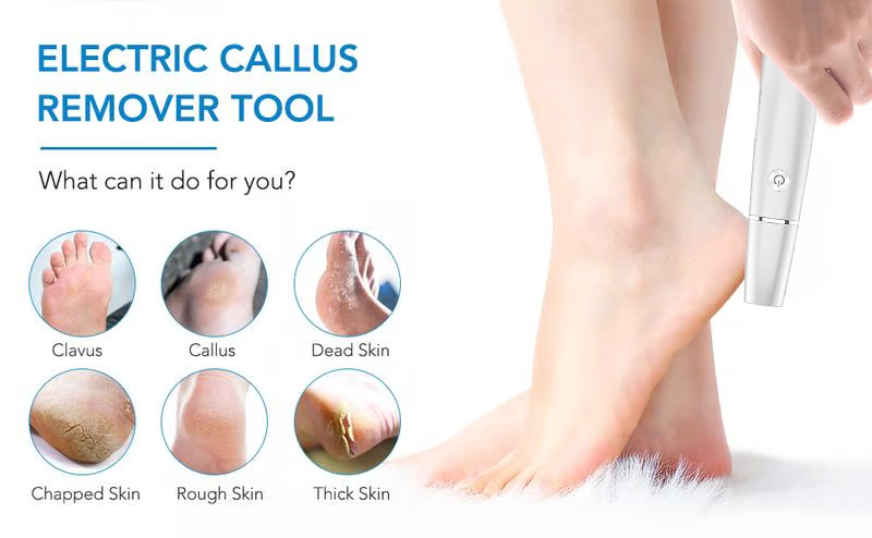 Electric Foot File and Callus Remover with Rechargeable Battery and Rotating Exfoliating Roller - Image 14