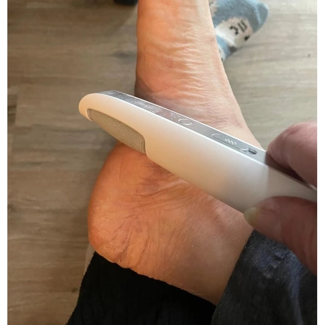 Electric Foot File and Callus Remover with Rechargeable Battery and Rotating Exfoliating Roller - Image 16