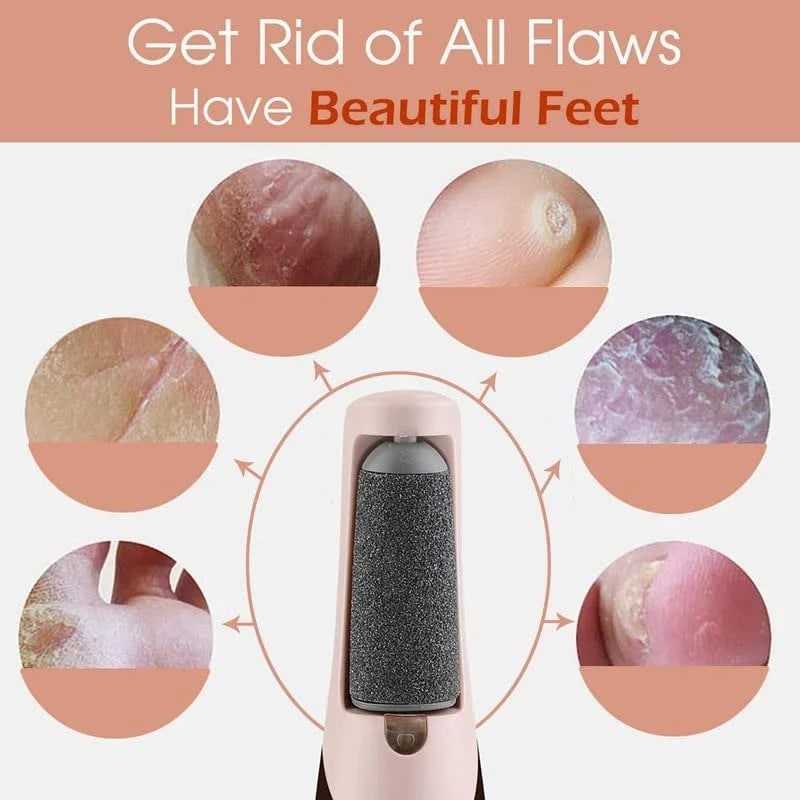 Electric Foot File and Callus Remover with Rechargeable Battery and Rotating Exfoliating Roller - Image 17