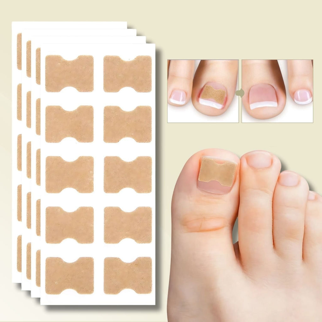 Ingrown Toenail Patches with Adhesive Backing for Nail Straightening 20 Count - Image 1