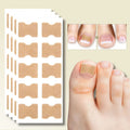 Ingrown Toenail Patches with Adhesive Backing for Nail Straightening 20 Count - Image 1