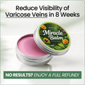Leg Swelling Cream with Horse Chestnut and Arnica Varicose Vein Balm - Image 1