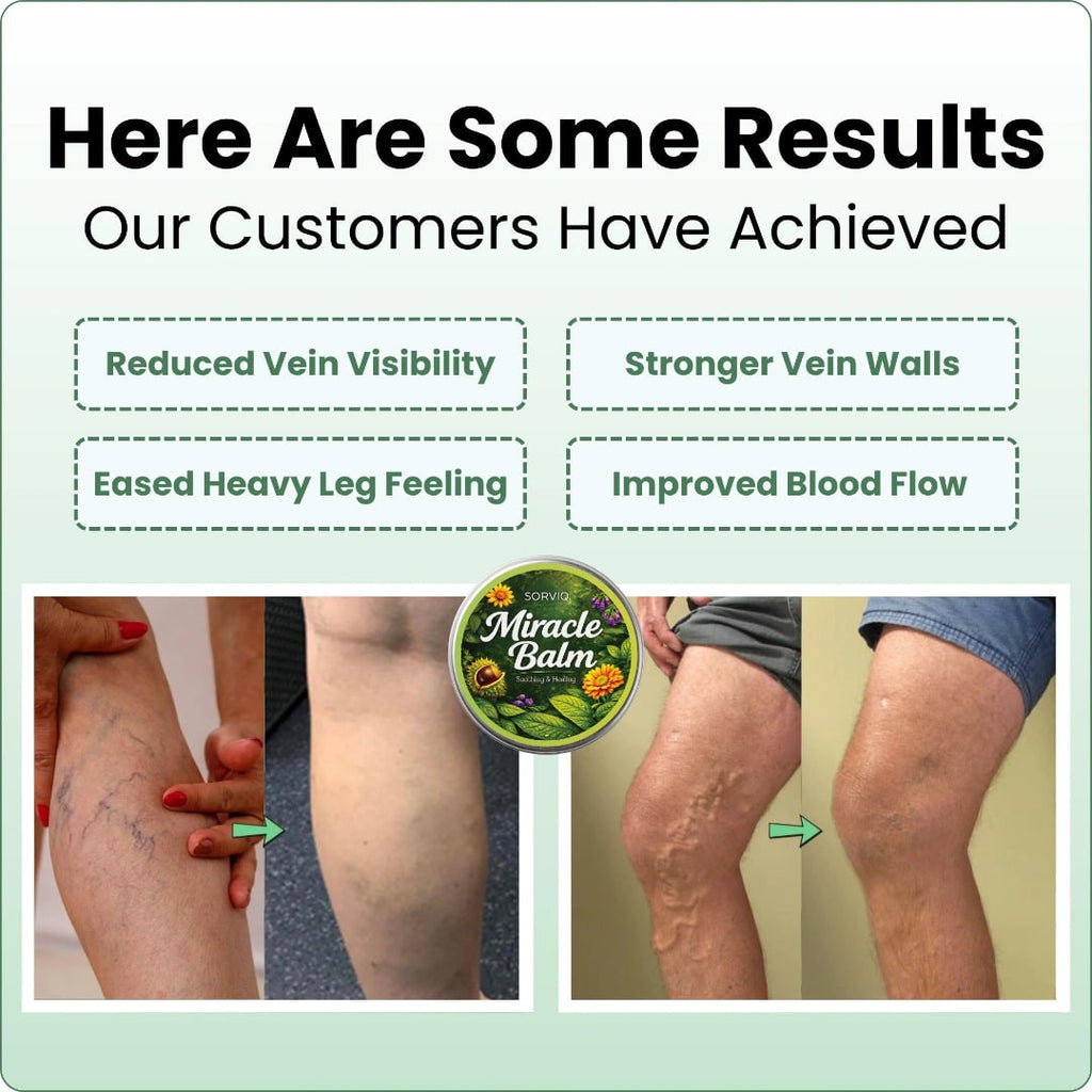 Leg Swelling Cream with Horse Chestnut and Arnica Varicose Vein Balm - Image 5