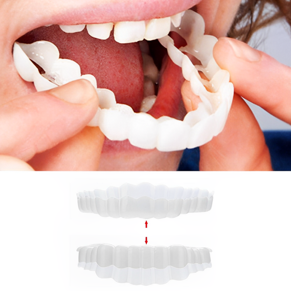 Snap on Veneers Cosmetic Dental Temporary Flexible Plastic Upper Lower - Image 1
