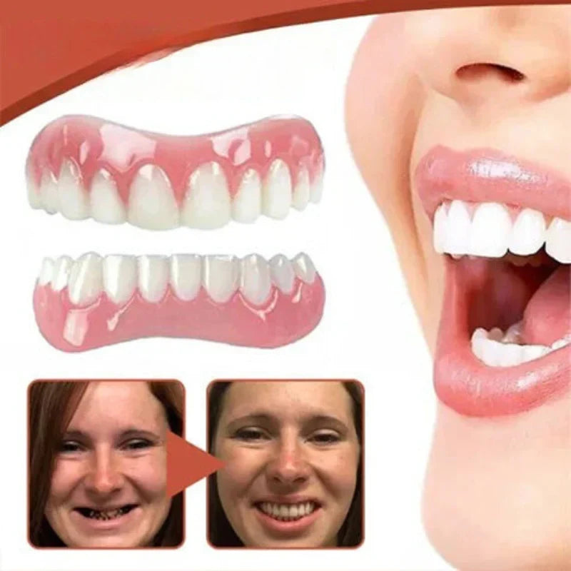 Snap on Veneers Custom Fit Moldable Teeth with Artificial Gums and Storage Case - Image 5